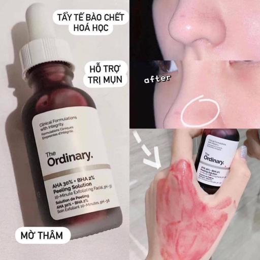 SERUM THE ORDINARY AHA30% + BHA2%